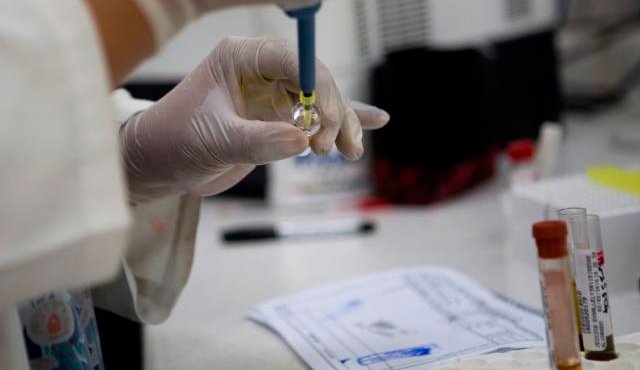 Analizan en laboratorios las formas de contagio. Internet