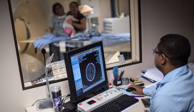 Entre 10 y 15% de los bebés con microcefalia no tienen un defecto sino que simplemente nacieron con cabezas pequeñas, y ello requiere más pruebas para determinar la causa exacta. AFP