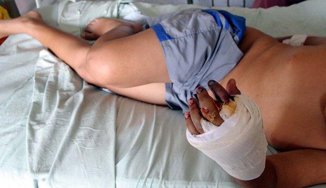 Las autoridades deben extremar los controles para que durante las fiestas de Navidad y Año Nuevo no se presenten niños quemados con pólvora. Archivo