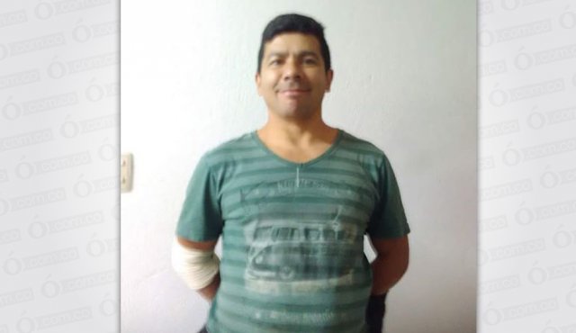 El agresor utilizó una segueta causándole una herida en el abdomen y en sus brazos. Cortesía