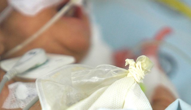 La bebé falleció esperando el traslado a un lugar donde le pudieran operar del corazón. Colprensa