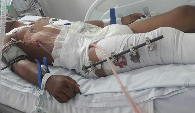 Los costos más altos se produjeron por accidentes de motociclistas. Alfredo Estévez