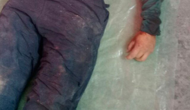 Yimer Rodríguez Campo quedó tendido en el piso. Cortesía