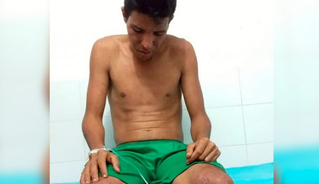 Familiares acudieron en su búsqueda, encontrándolo en tan malas condiciones que cruzaron la frontera y lo llevaron al puesto de salud de Puerto Santander. Cortesía