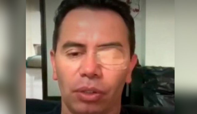 Rivera indicó que pese al dolor, siguió con su actuación, para no decepcionar al público que fue a verlo. Tomada de Twitter