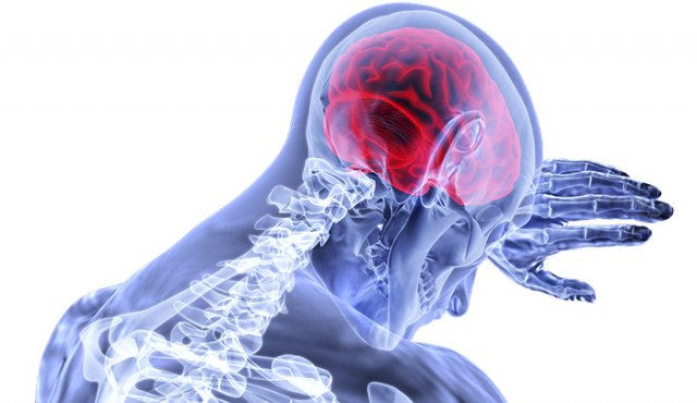 Según el reporte publicado en la revista científica Brain. Pixabay / referencial