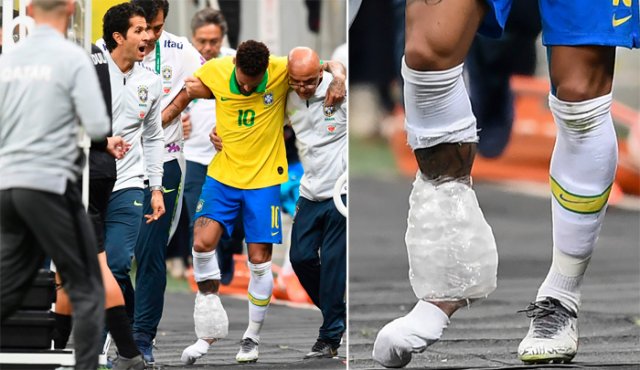 La Confederación Brasileña de Fútbol (CBF) informó la madrugada del jueves que Neymar sufrió una "ruptura de ligamentos en el tobillo derecho". AFP