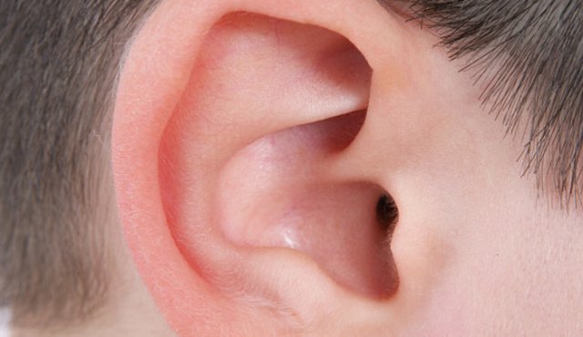 La microtia con atresia es una condición poco común. Freepik.es