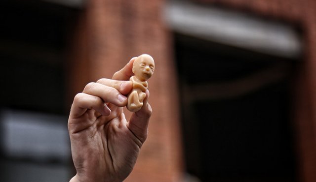 Las causales del aborto son: riesgo físico o psicológico de la mujer,grave malformación el el feto y/o en caso de violación o inseminación no consentida. Colprensa