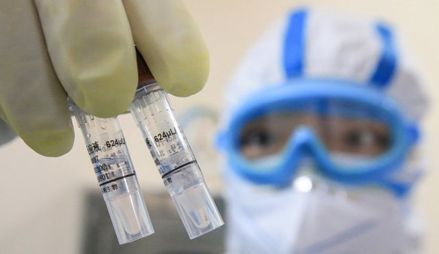 En total, más de 74.500 personas han sido contagiadas en China desde la irrupción del nuevo coronavirus en diciembre. AFP