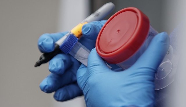 Muestras de laboratorio. Colprensa