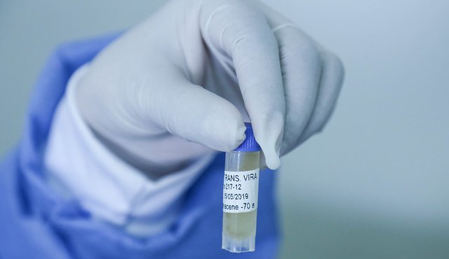 Estudio para hallar una vacuna contra el coronavirus. Colprensa