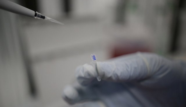 Desde el primer caso confirmado en colombia, 1.185.984 muestras se han procesado. Colprensa