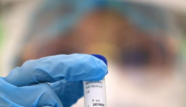 Este virus puede ser realmente nocivo en algunas personas. Archivo