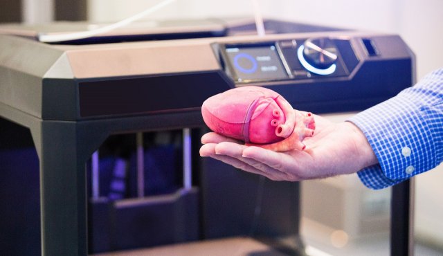 La utilización de modelos 3D digitales o modelos impresos en 3D puede ser decisiva en la definición del tratamiento de los pacientes. Cortesía