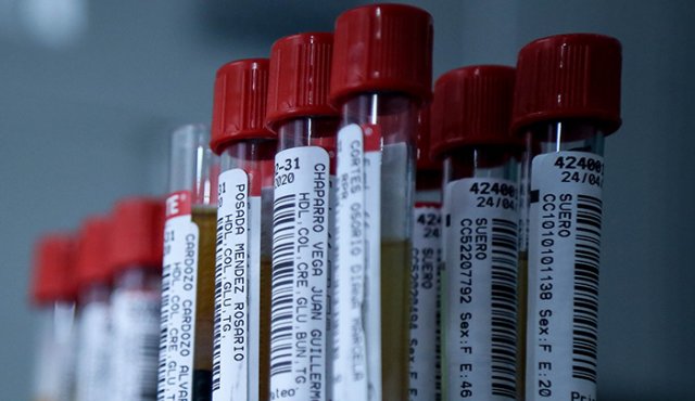 Hoy se procesaron 24.030 pruebas PCR y 7.813 de antígenos en el país. Colprensa