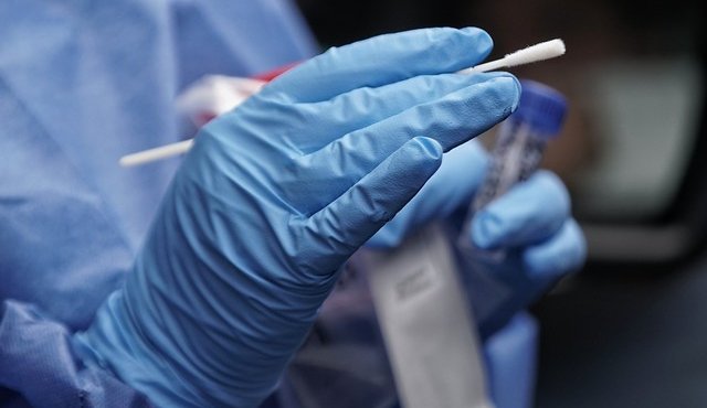 Isopo para pruebas COVID-19. Colprensa
