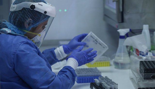 Exámenes de detección de la COVID-19. Colprensa