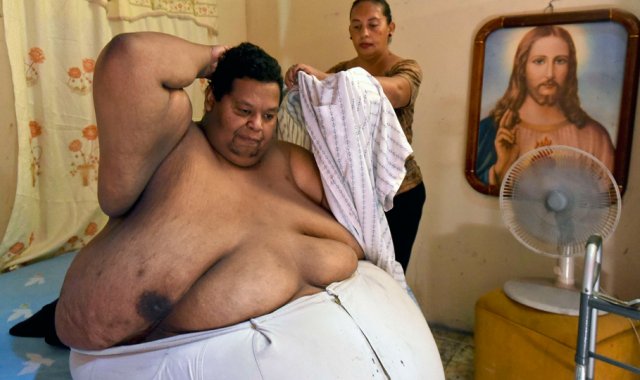 El caso de obesidad de Óscar Vásquez es el más grave registrado en Colombia por la Fundación Gorditos de Corazón. AFP