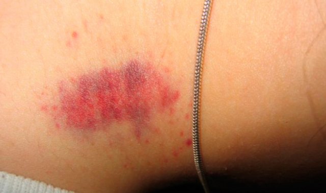 Internet | Referencial