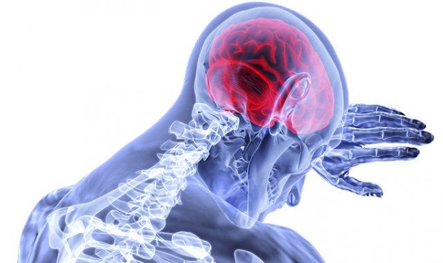 Pixabay / referencial