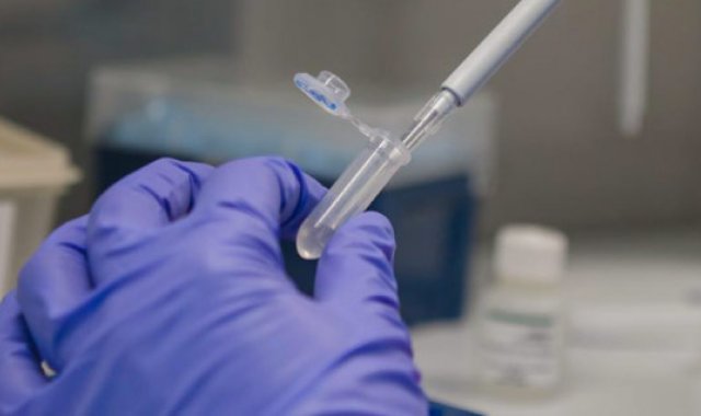 Estas pruebas permiten la optimización de recursos en la lucha contra la propagación del virus- Cortesía