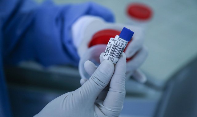 27 departamentos del país contarán con estos recursos. Colprensa.