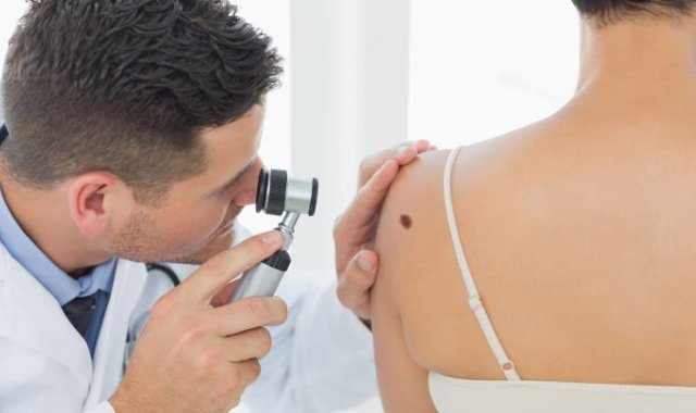 El 13 de junio de cada mes se conmemora la lucha contra el cáncer cutáneo, enfermedad asociada con la exposición al sol y los rayos ultravioleta. Colprensa