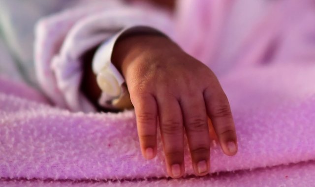 El bebé presentó síntomas severos, como rigidez de las extremidades y lesiones en el sistema nervioso cerebral y que fueron desapareciendo poco a poco. AFP