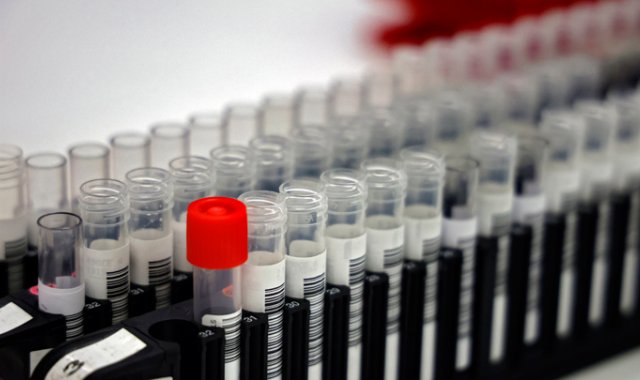 Las transfusiones de plasma contribuyeron a mejorar las dificultades respiratorias y el cansancio. AFP