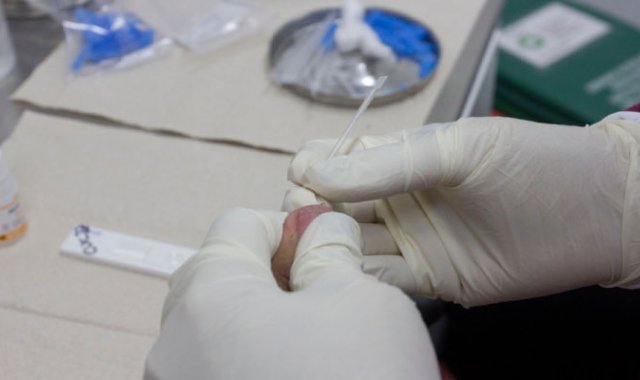 Jornadas extendidas de toma de muestras para VIH/Sida Luis Alfredo Estévez/ La Opinión